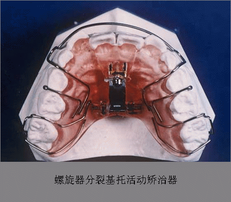 足球即时比分